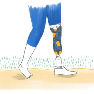 Marche avec une prothèse